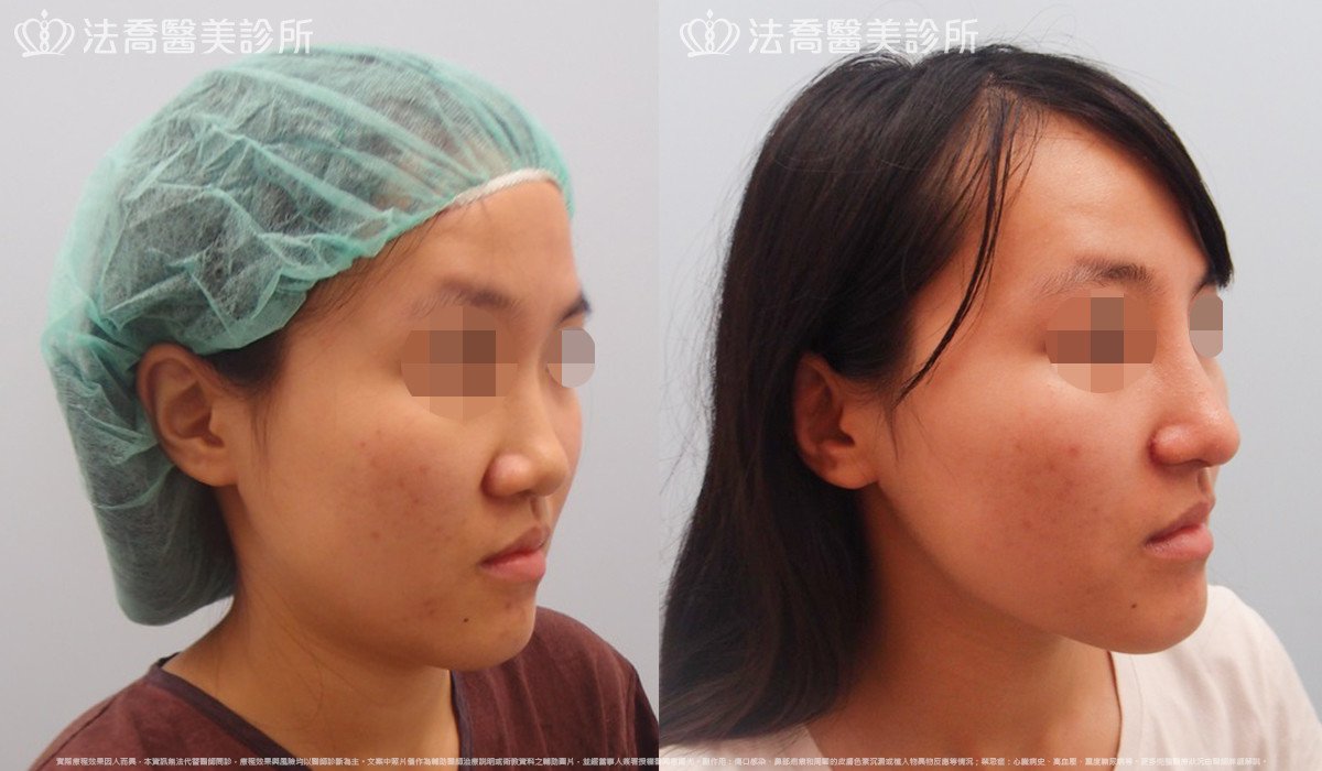 法喬醫美診所 邱浚彥醫師