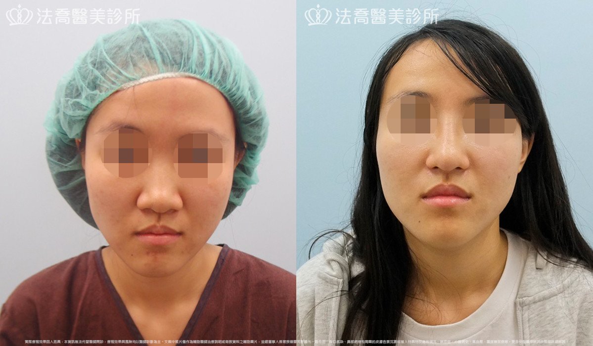 法喬醫美診所 邱浚彥醫師