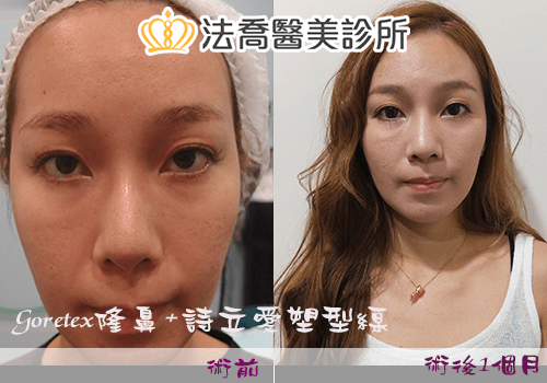 法喬醫美診所 邱浚彥醫師