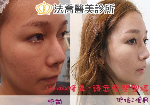 法喬醫美診所 邱浚彥醫師