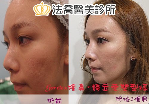 法喬醫美診所 邱浚彥醫師
