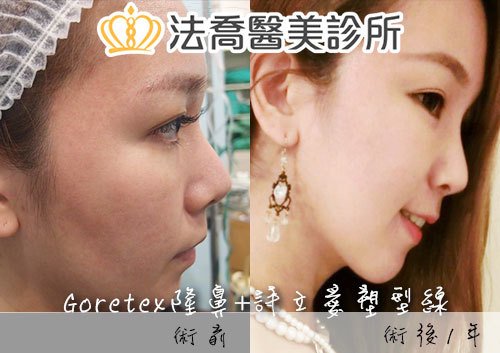 法喬醫美診所 邱浚彥醫師