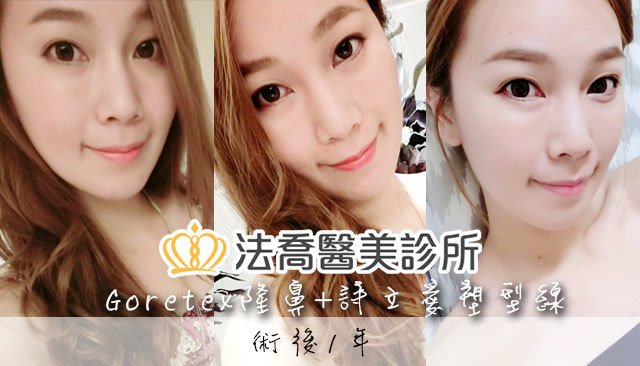 法喬醫美診所 邱浚彥醫師