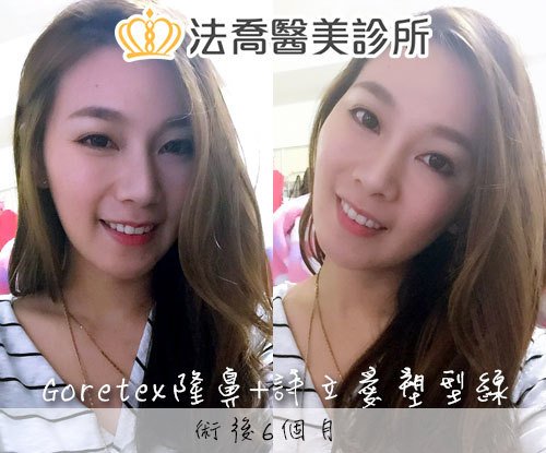 法喬醫美診所 邱浚彥醫師