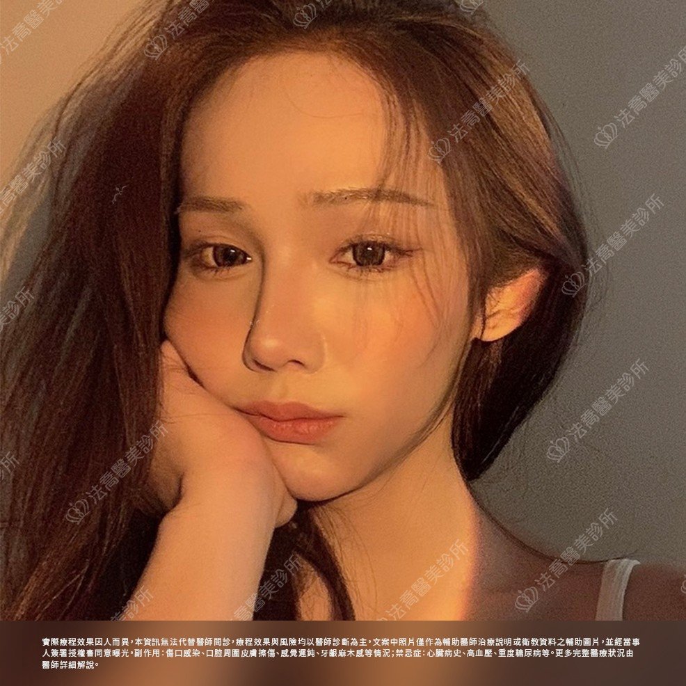 術後6個月生活照