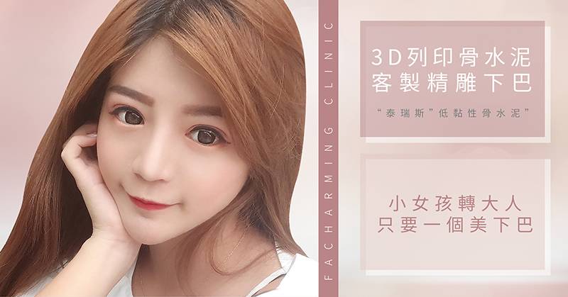 法喬醫美診所-3D列印骨水泥客製化下巴