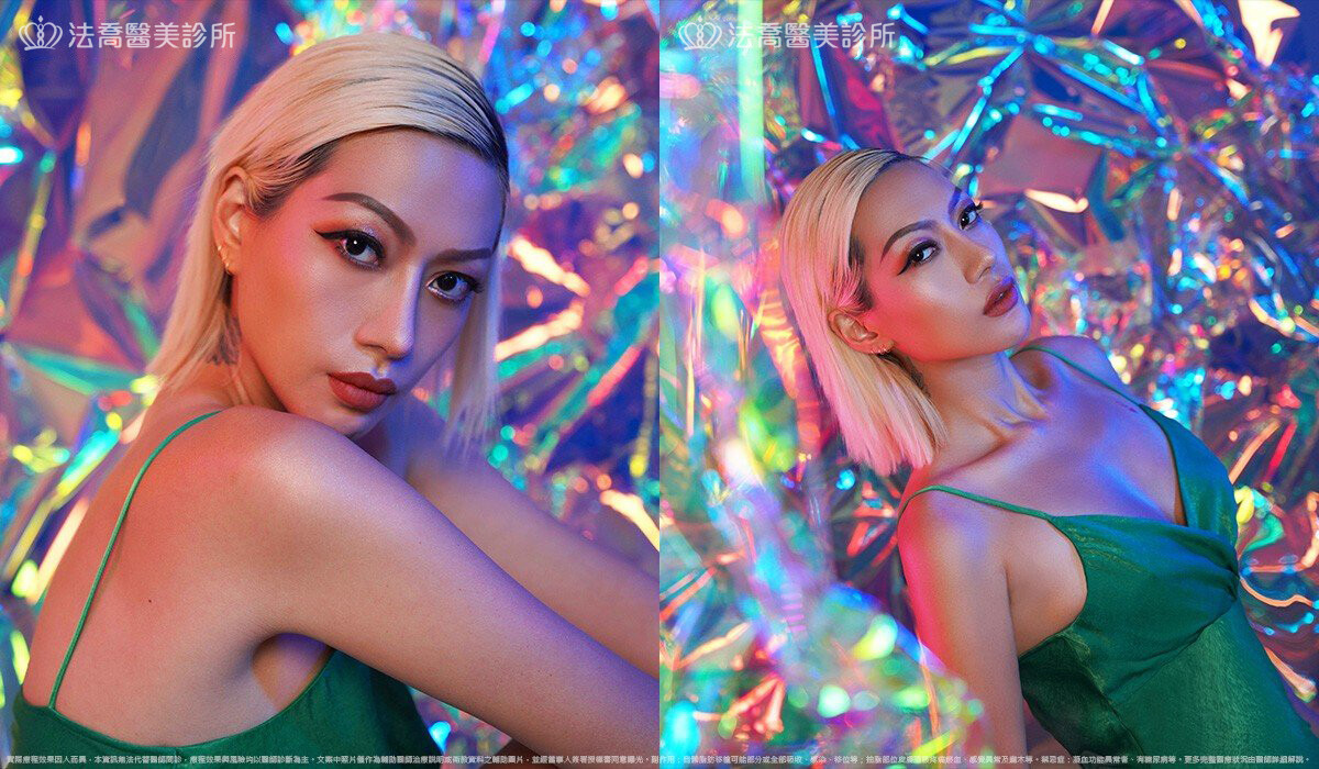 人工骨墊下巴(俗稱)