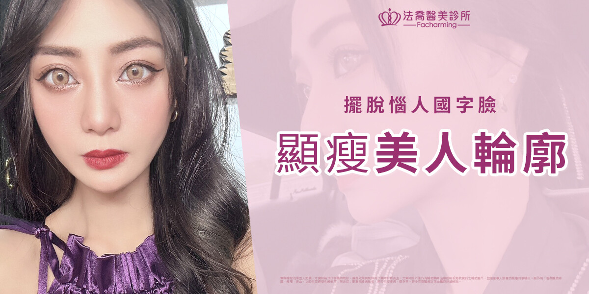 法喬醫美Ellanse洢蓮絲少女針