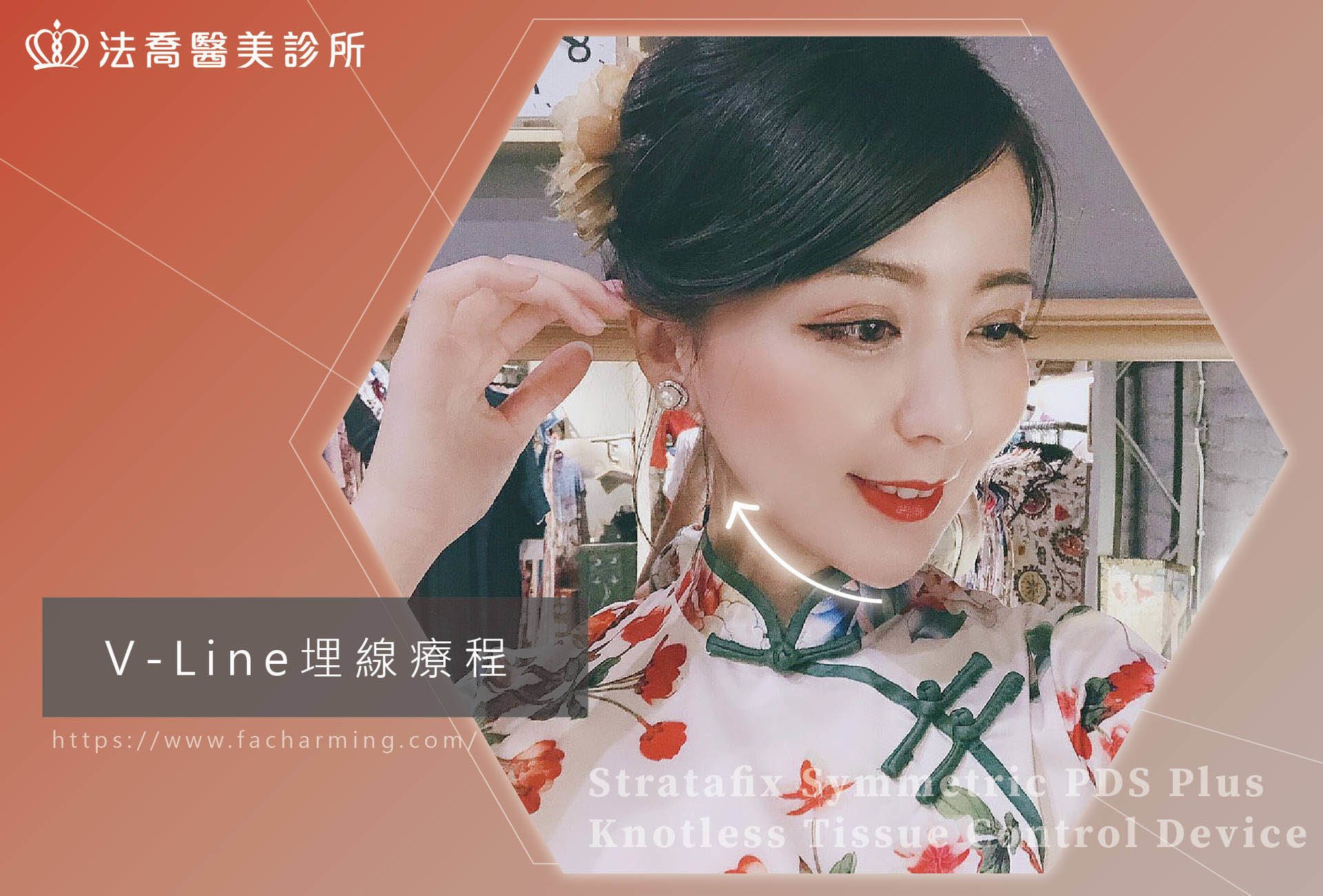 法喬醫美診所,埋線療程