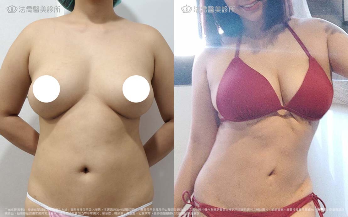 溶脂