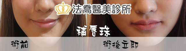 法喬醫美診所 邱浚彥醫師