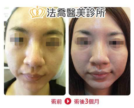 法喬醫美診所 邱浚彥醫師