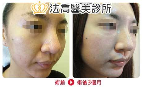法喬醫美診所 邱浚彥醫師