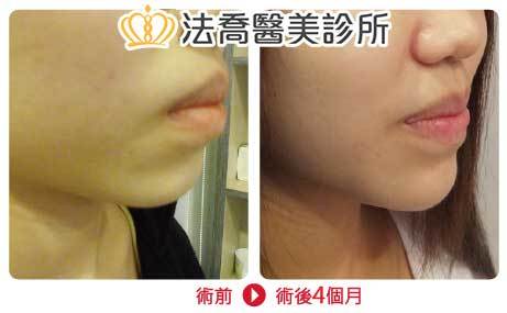法喬醫美診所 邱浚彥醫師