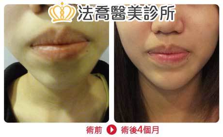 法喬醫美診所 邱浚彥醫師