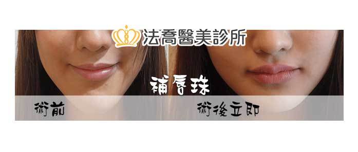 法喬醫美診所 邱浚彥醫師