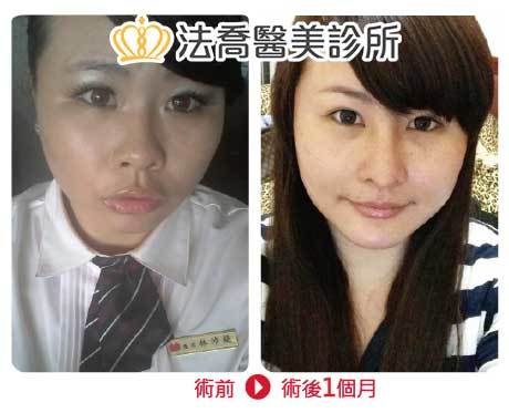 法喬醫美診所 邱浚彥醫師