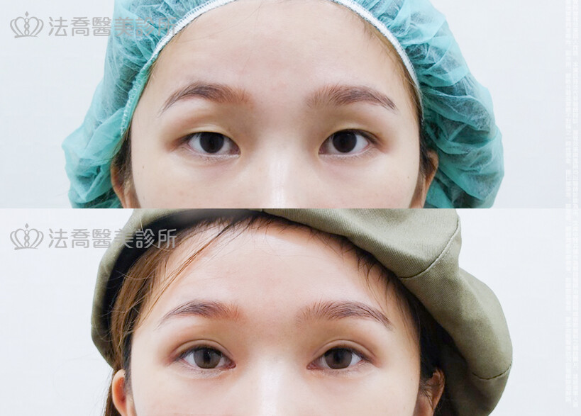 法喬維美醫美診所