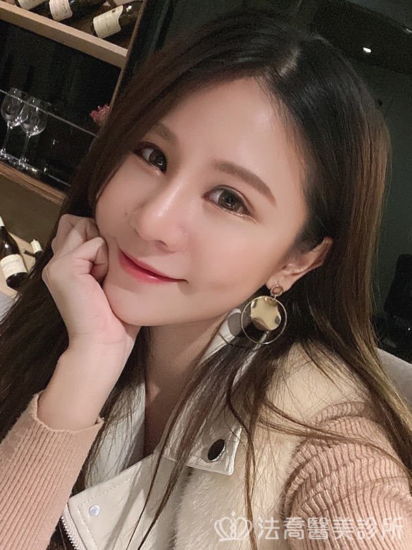 法喬醫美診所 邱浚彥醫師 自體肋骨隆鼻