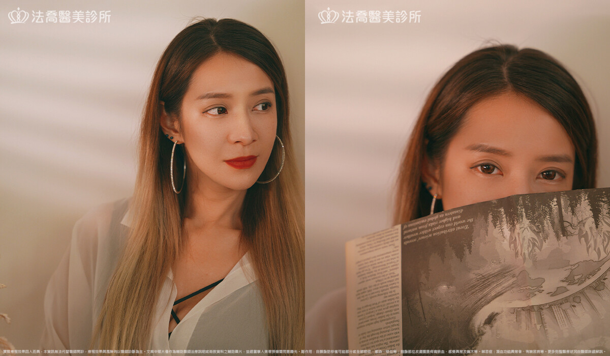 眼袋內開、脂肪移位 / 術後3個月