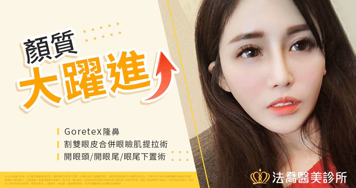 割雙眼皮合併眼瞼肌提拉術, 開眼頭,開眼尾,眼尾下置術