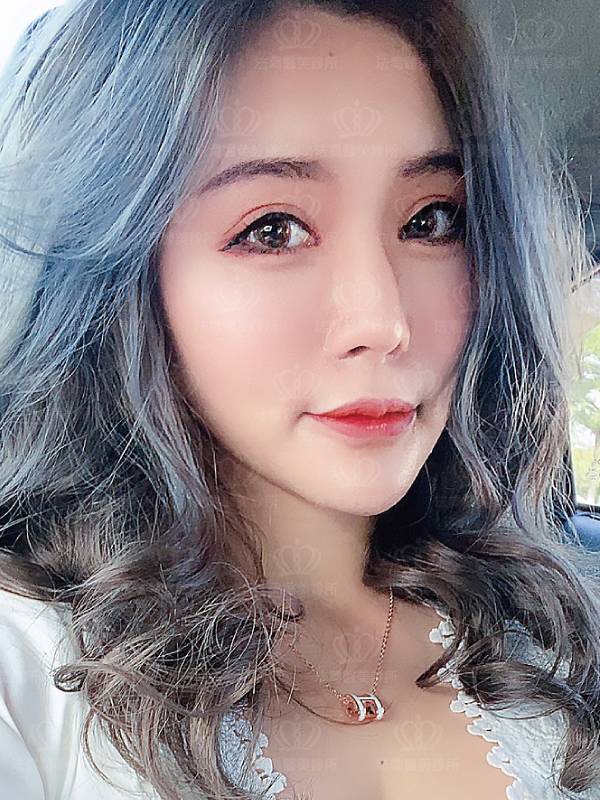 法喬醫美診所_割雙眼皮合併提眼瞼肌+開眼頭開眼尾+眼尾下置