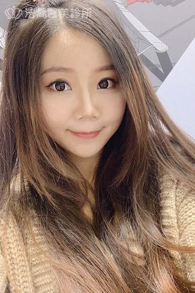 自體肋骨隆鼻