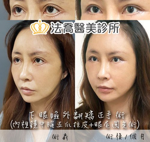 法喬醫美診所 邱浚彥醫師