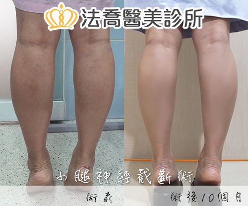 法喬醫美診所 邱浚彥醫師