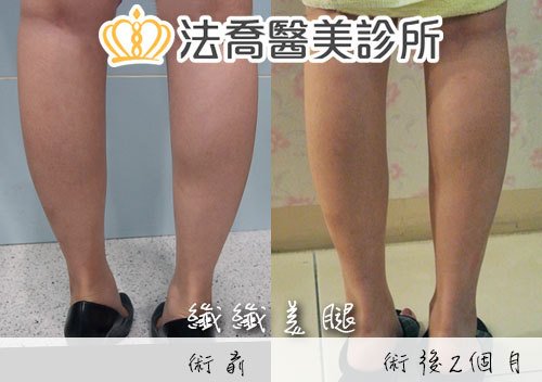 法喬醫美診所 邱浚彥醫師