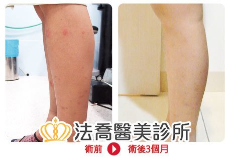 法喬醫美診所 邱浚彥醫師