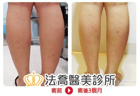 法喬醫美診所 邱浚彥醫師