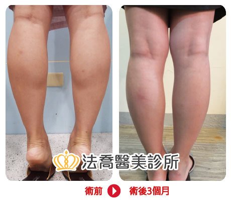 法喬醫美診所 邱浚彥醫師
