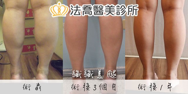 法喬醫美診所 邱浚彥醫師