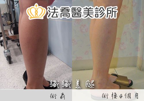法喬醫美診所 邱浚彥醫師