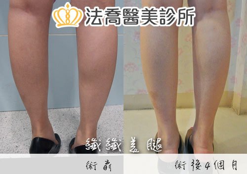 法喬醫美診所 邱浚彥醫師