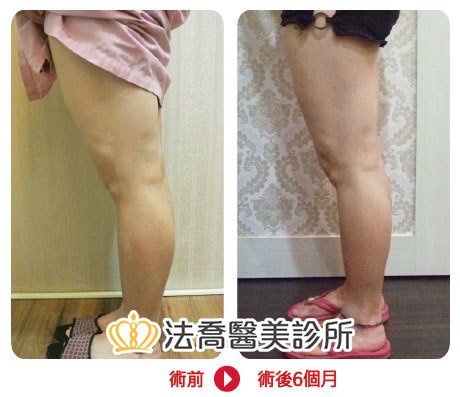 法喬醫美診所 邱浚彥醫師