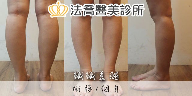 法喬醫美診所 邱浚彥醫師