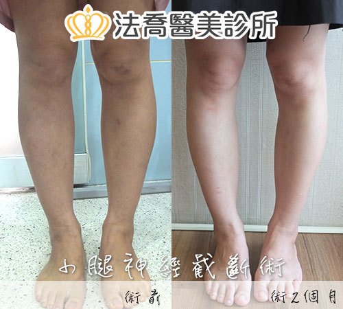 法喬醫美診所 邱浚彥醫師