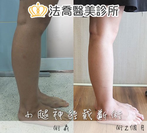 法喬醫美診所 邱浚彥醫師