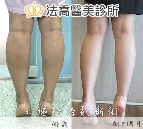 法喬醫美診所 邱浚彥醫師