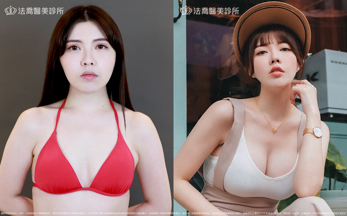 法喬維美醫美診所