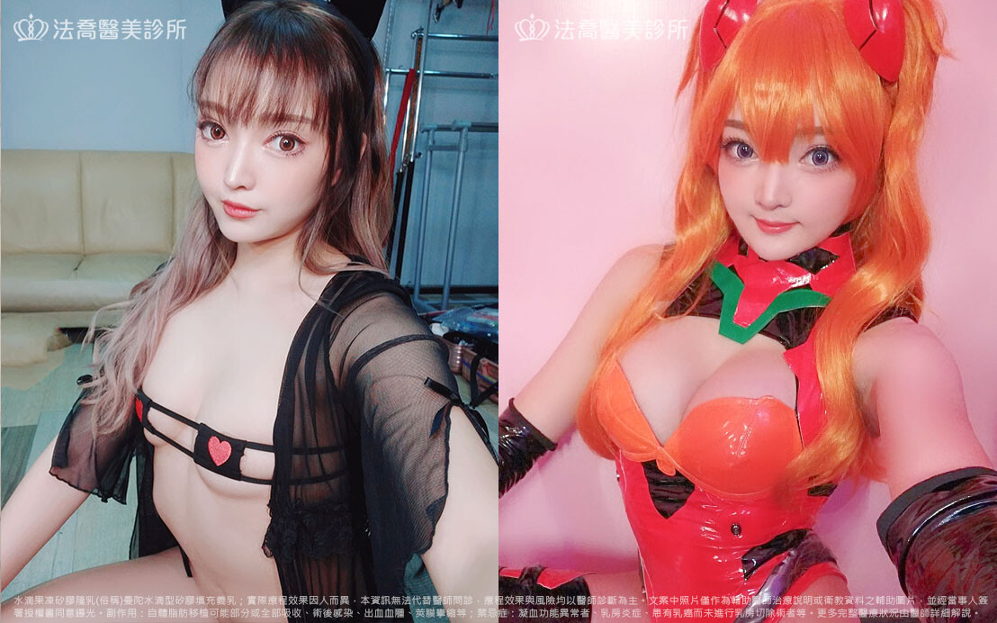 法喬醫美診所,邱浚彥,隆乳推薦