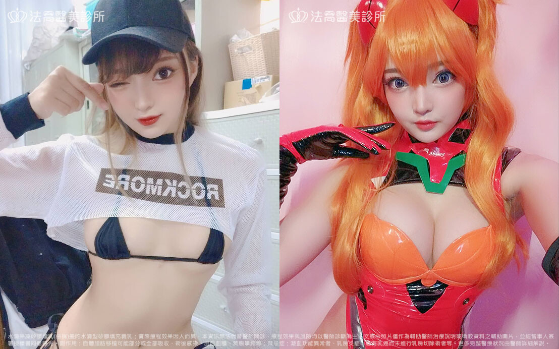 法喬醫美診所,邱浚彥,隆乳推薦