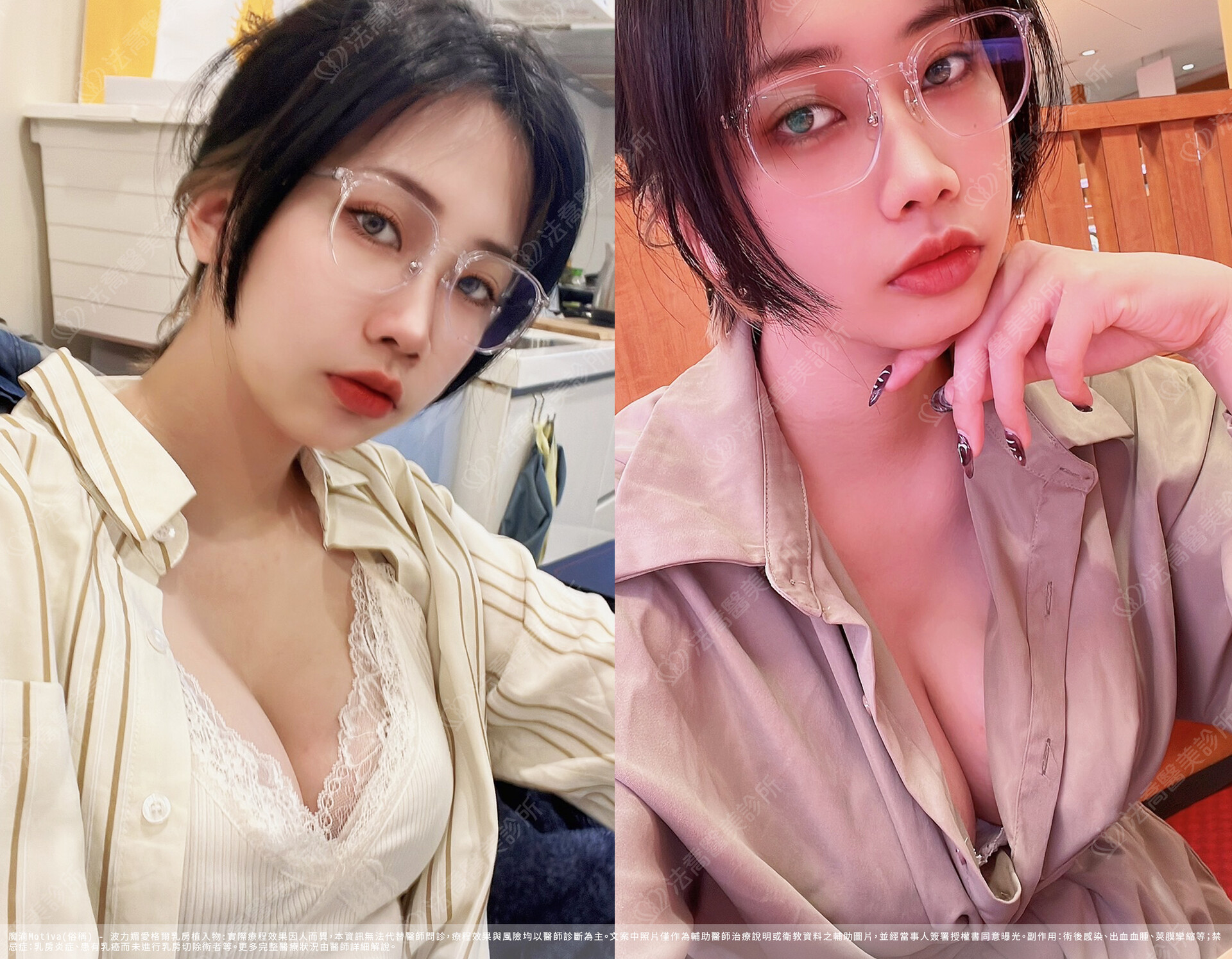 法喬醫美診所,邱浚彥,魔滴隆乳,隆乳推薦