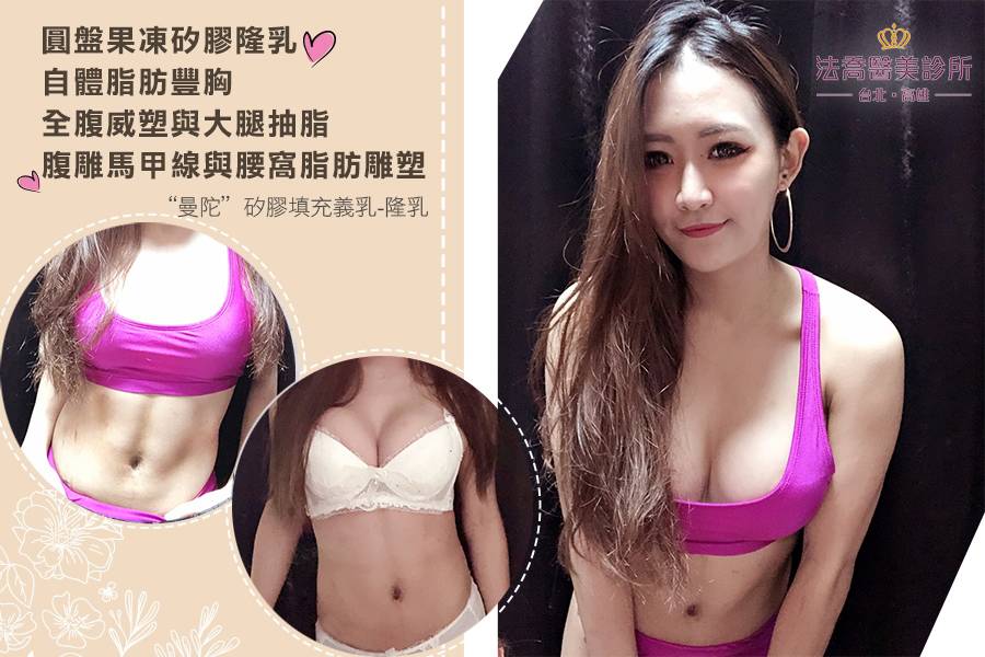 法喬醫美診所《參參》【複合式隆乳】果凍矽膠隆乳 X 自體脂肪豐胸 X 威塑全腹抽脂 X 威塑大腿環抽 X 威塑腹雕馬甲線 X 威塑腰窩雕塑,高雄隆乳推薦