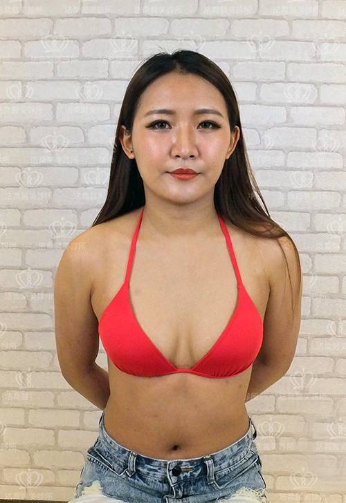 法喬醫美診所_複合式隆乳術前照