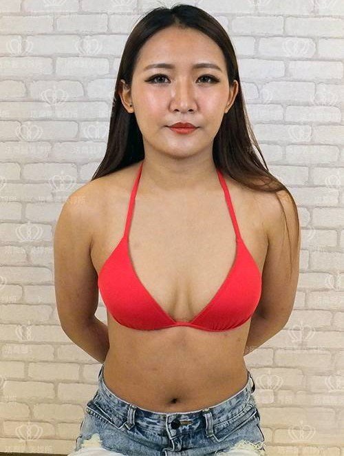 法喬醫美診所_複合式隆乳+威塑腹雕
