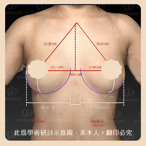 法喬醫美診所_3D模擬
