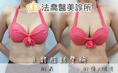 法喬醫美診所 邱浚彥